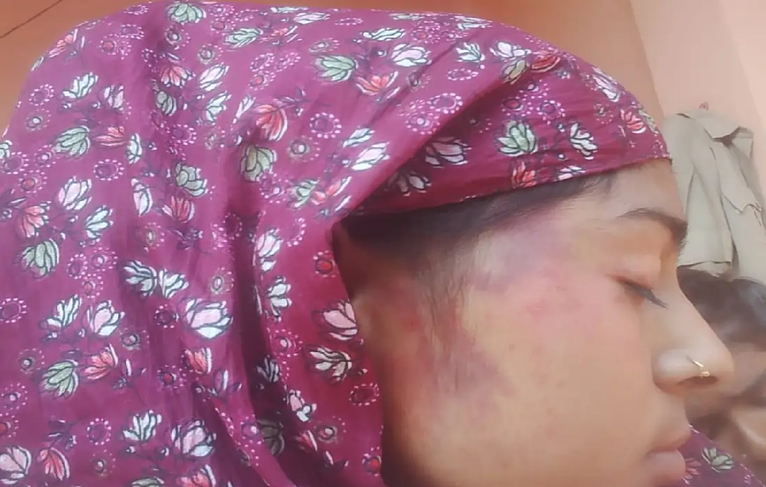 Dalit family beaten up, Caste discrimination