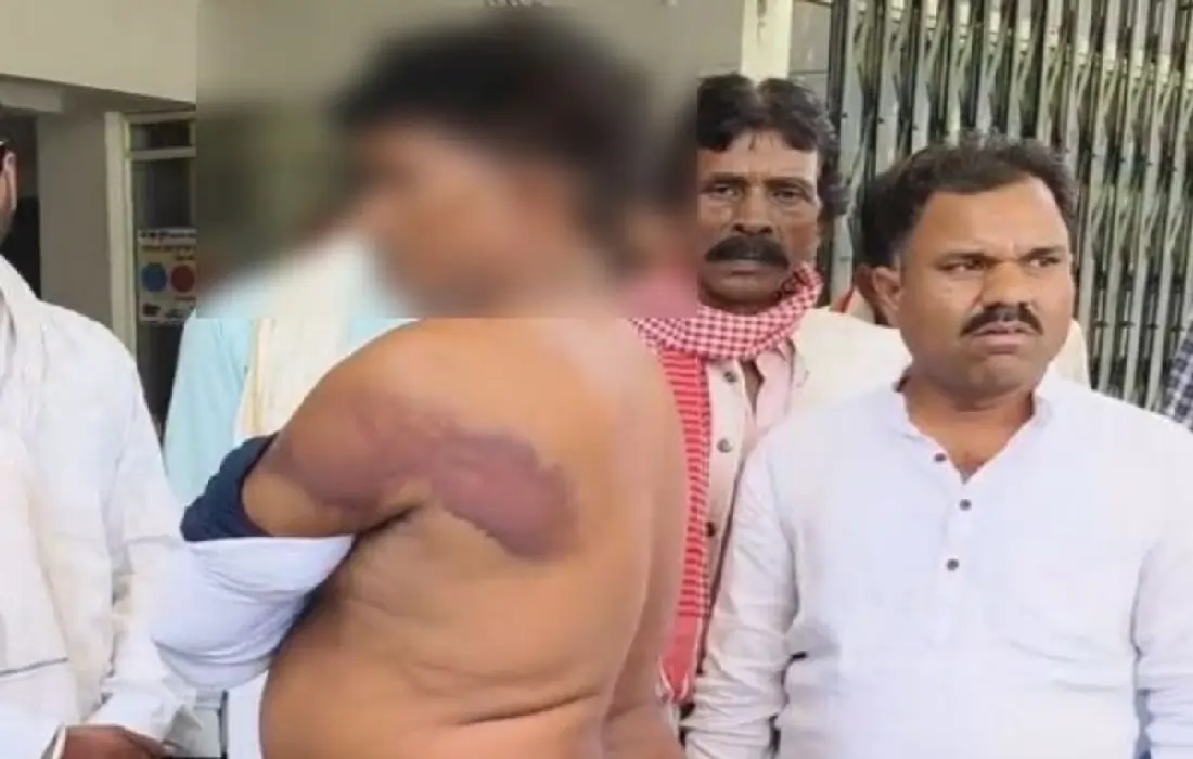 Vidisha news, Police beaten Dalit men